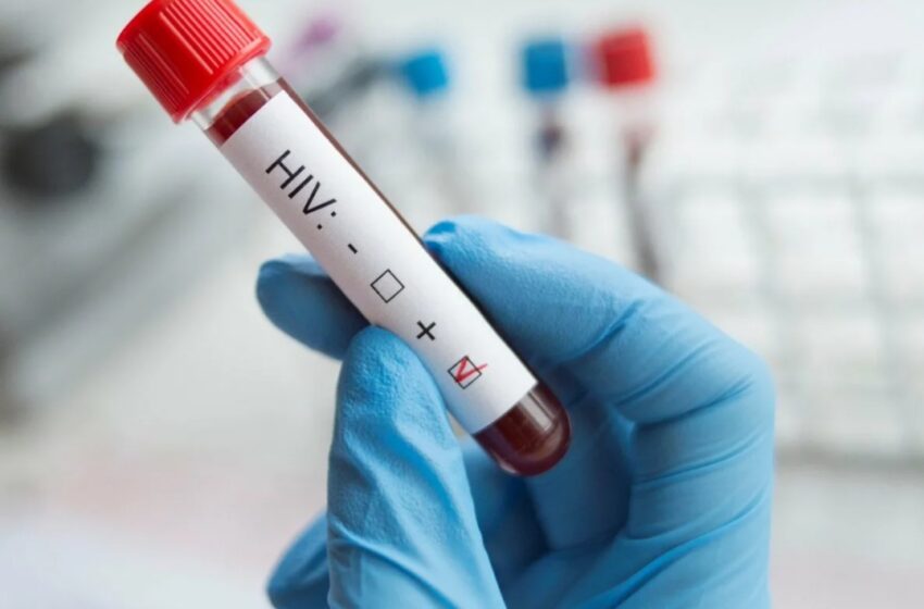 کشف سویه بسیار خطرناک HIV در هلند