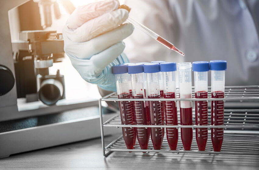  کمبود لوله خون می تواند آزمایش های غیر ضروری را محدود کند