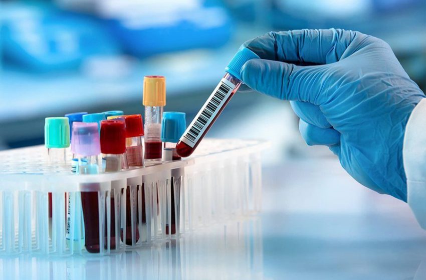 ابتلا به آبله میمونی