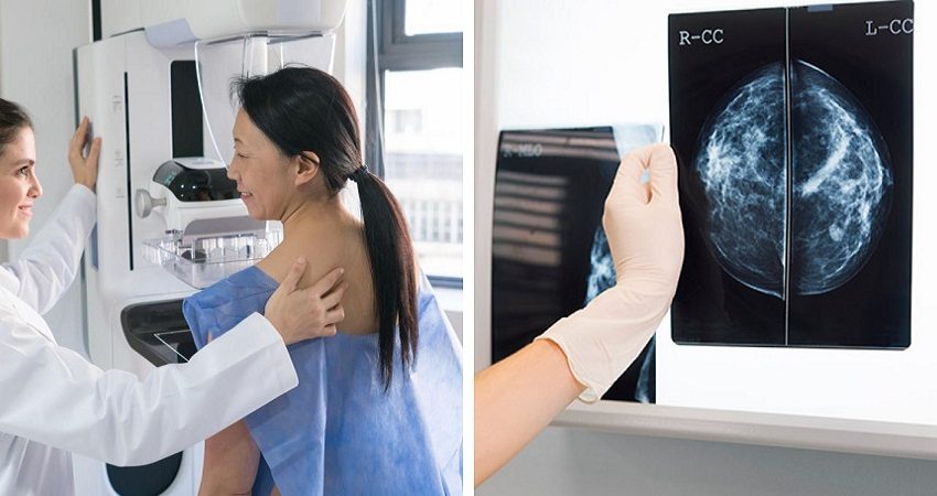 انجمن رادیولوژیست‌ها